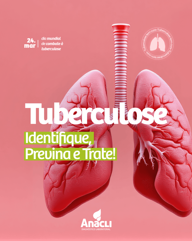 Tuberculose: conhecimento é o melhor remédio!