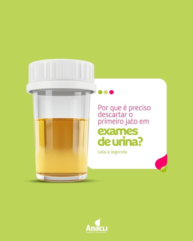 Por que descartar o primeiro jato de urina é essencial no exame?